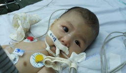 Xót xa em bé 5 tháng tuổi không thể sống quá 2 tuổi vì bệnh hiếm gặp