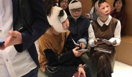 Khuôn mặt 'biến dạng' sau phẫu thuật thẩm mỹ, 3 phụ nữ bị chặn ở sân bay