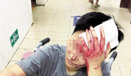 Thực khách Trung Quốc bị nhân viên giao hàng hành hung chảy máu đầu