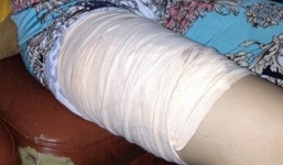 Truy bắt thủ phạm gây ra hàng loạt vụ rạch đùi, chích kim tiêm phụ nữ