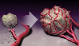 Tổ chức Y tế Thế giới: 10 sự thật về ung thư, nếu biết sớm thì sẽ phòng ngừa tốt hơn