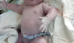 Vĩnh Phúc: Kỷ lục bé trai vừa chào đời đã nặng 7,1 kg