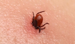 Mất trí nhớ, liệt toàn thân vì bị ve cắn 16 năm trước