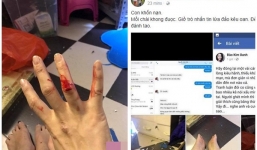 Thực hư thông tin Xuân Bắc đánh vợ đến bật máu