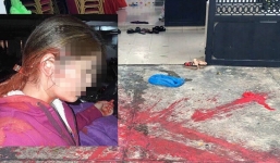 Nữ chủ tiệm spa liên tục bị 'khủng bố' bằng sơn và mắm tôm và tung tin giả bán dâm