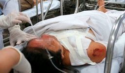 Cụ ông tạt axit người  tình kém 22 tuổi vì ghen