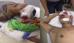 Đang ngồi uống bia, 2 nam thanh niên bị nhóm côn đồ truy sát