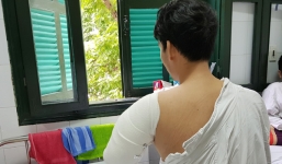 Nam thanh niên bị máy tuốt lúa 'nuốt trọn' cánh tay