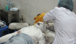 Đôi vợ chồng trẻ bị bỏng nặng vì chồng búng tàn thuốc trúng chai xăng