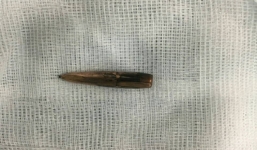 Nguyên nhân ban đầu vụ đạn bay lạc găm trúng nhiều người ở Vĩnh Phúc