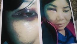 Vợ bị bồ nhí đánh ghen ngược vì nhắn tin nhắc nhở đừng liên lạc với chồng mình