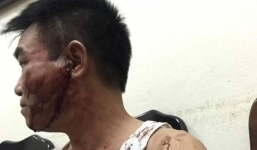 Hà Nội: 2 vợ chồng cán bộ thanh tra đánh anh trai nhập viện