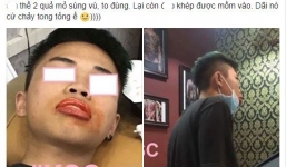 Chàng trai quyết định đập môi thâm đi xây lại và cái kết không đẹp cho lắm