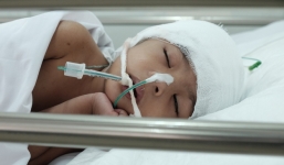 Mẹ bé gái 3 tuổi té cầu thang chấn thương sọ não nặng khi theo mẹ đi giúp việc: “Tôi không bỏ con mình'