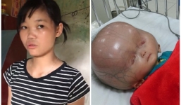 Mẹ bé trai bị não úng thủy: 'Muốn con ở bên vòng tay mẹ và bà được ngày nào hay ngày đó'