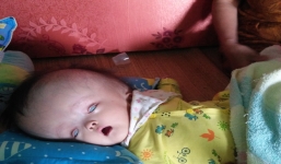 Cuộc sống đau đớn của bé gái 8 tháng tuổi mồ côi cha, cái đầu như muốn 'nổ tung' vì căn bệnh não úng thủy