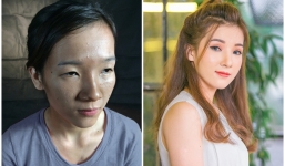 Cô gái 'mắt lươn' lột xác 180 độ sau PTTM: Phải sống thật tốt để người từng chê mình thấy hối hận!