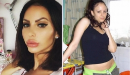 Cô gái trẻ chi hơn 6 tỷ đồng thẩm mỹ để biến mình thành búp bê Barbie