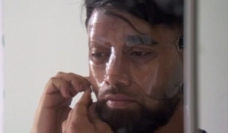 Ngược đời: Nam thanh niên bị tạt axit - cơn ác mộng chưa hồi kết ở thủ đô nước Anh