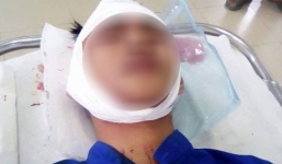 Nhóm thanh niên thấy người là chém khiến người dân Đồng Nai hoang mang