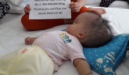 Đã quyên góp được gần 500 triệu đồng chuẩn bị cho ngày mai đưa bé gái 'đầu to' đi Singapore chữa bệnh