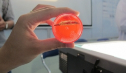 Hóc xương gà mà tự chữa, 1 phụ nữ suýt mất mạng