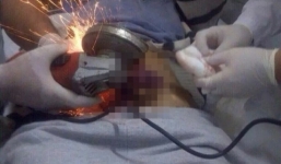 Bé trai 13 tuổi suýt bị hoại tử dương vật vì đeo nhẫn cho 'của quý'