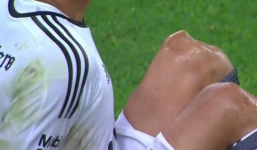 Nhìn thấy chấn thương ghê rợn, thủ môn khóc ngất tại sân