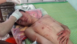 2 đối tượng xông vào trường, đánh thầy giáo và học sinh nhập viện