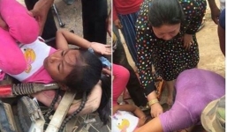 Người dân lúng túng giải thoát bé gái tóc dài bị cuốn vào bánh xe máy
