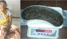 Chụp X-quang, bác sĩ phát hiện nhiều vật lạ trong chân cô gái và không thể tin nổi khi lấy ra