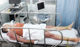 'Thầy pháp' dùng roi đánh 2 chị em thừa sống thiếu chết vì cho rằng bị ma nhập