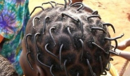 Ai cũng giật mình tưởng hàng chục con sâu ngoe nguẩy trên đầu cậu bé, lại gần mới bật cười