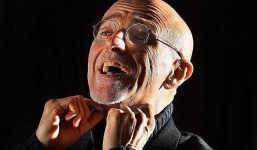 Bác sĩ Ý tuyên bố ca ghép đầu người chấn động đã xong khâu...diễn tập