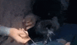 Bác sĩ phát hiện vật thể lạ trong bụng người đàn ông phát hoảng