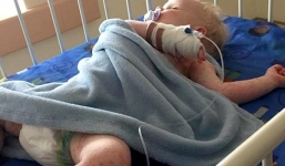 Bé trai 16 tháng tuổi suýt mất mạng vì nhiễm loại virus nguy hiểm chỉ sau 1 nụ hôn của người lớn