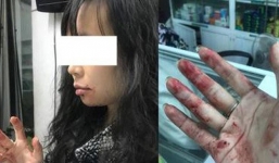 Công an điều tra loạt tin nhắn đe dọa nữ hành khách bị tài xế Uber đánh bầm mặt,