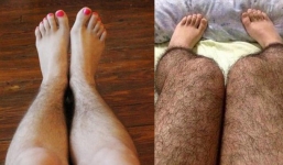 Điều kinh hoàng gì đã khiến nữ giới luôn mịn màng lại 'lắm lông' thế này?