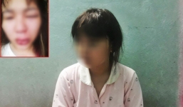 Giúp người gặp nạn đi viện, cô gái bị chính nạn nhân đánh rách môi, lệch sống mũi