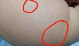 Học sinh mẫu giáo bị bạo hành, đâm kim và bắt ăn thuốc lạ gây xôn xao ở Trung Quốc