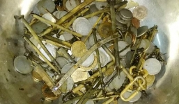 Lấy ra 263 đồng xu, 100 chiếc đinh trong bụng bệnh nhân