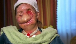 Người phụ nữ bị hủy hoại khuôn mặt chỉ vì thay đổi kiểu tóc