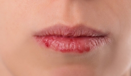 Có những dấu hiệu này chứng tỏ bạn cần giải độc cơ thể ngay lập tức