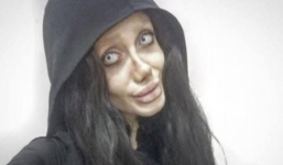 Cô gái Iran phẫu thuật hơn 50 lần để giống Angelina Jolie nhưng lại hóa 'cô dâu ma'