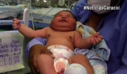 Bé sơ sinh nặng 6,4 kg, dài 55 cm khiến sản phụ không tin vào mắt mình