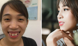 Cô gái bị chê là 'khỉ đột rừng Amazon', 21 năm sống trong đau khổ và sự lột xác ngoạn mục