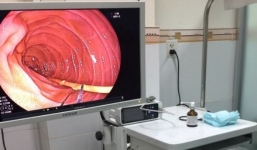 TP.HCM: Nhậu xỉn, người đàn ông 35 tuổi nuốt luôn 6 cây nhang, 1 khối cẩm thạch vào bụng vì… thiếu mồi