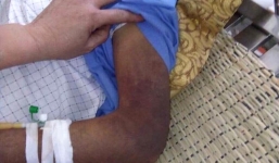 Trưởng công an huyện thông tin vụ con đánh bố gãy xương sườn