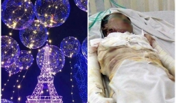 Bóng bay đèn led phát nổ, 4 người bỏng nặng nhập viện nguy kịch