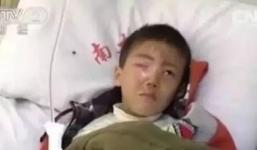 Bé trai 8 tuổi bị mù mắt do nghịch gói hút ẩm